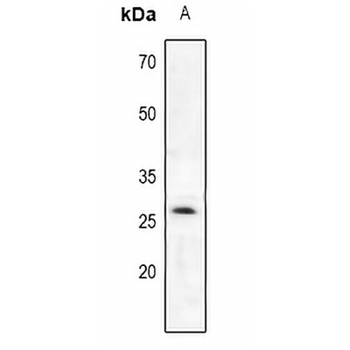 Trypsin 2 Rabbit Polyclonal Antibody