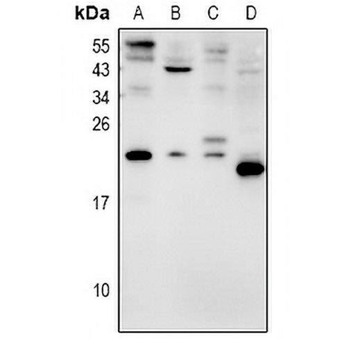 AVP Rabbit Polyclonal Antibody