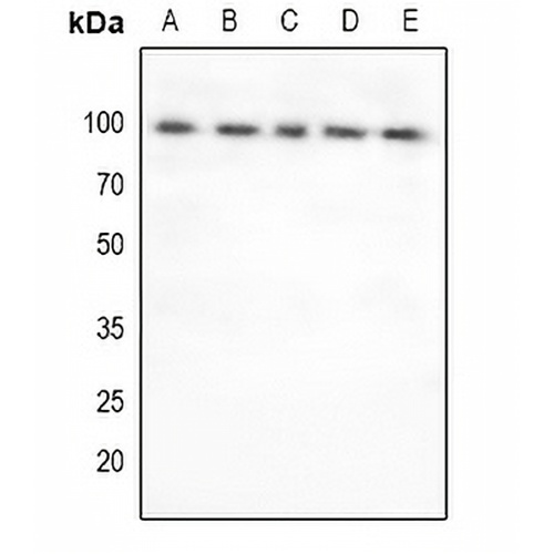 FOXO3 Rabbit Polyclonal Antibody