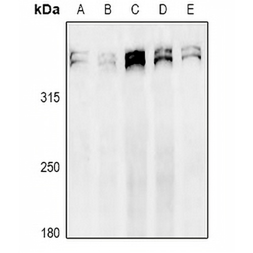 Ki67 Rabbit Polyclonal Antibody