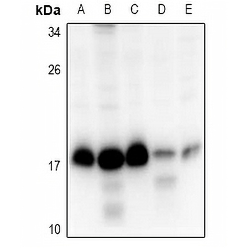 RPS15 Rabbit Polyclonal Antibody