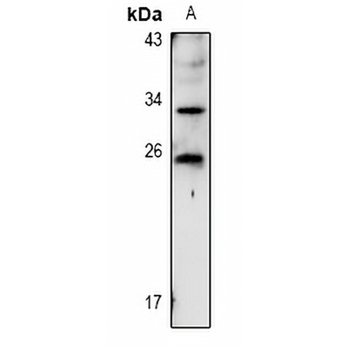 TIG1 Rabbit Polyclonal Antibody