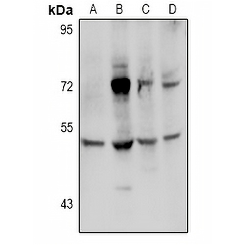Transglutaminase 3 Rabbit Polyclonal Antibody