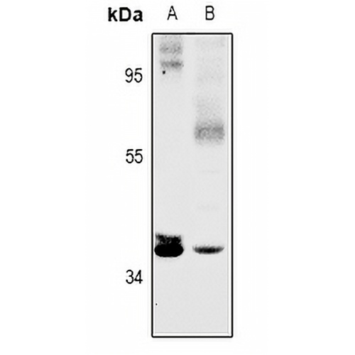 SFXN4 Rabbit Polyclonal Antibody