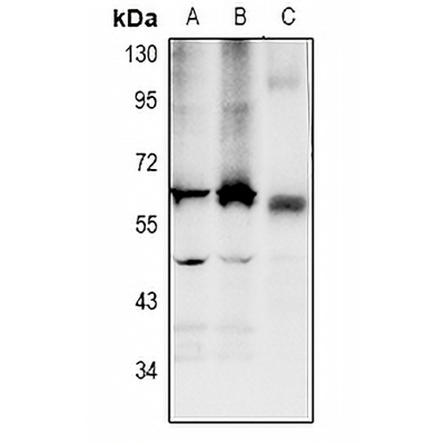 LPCAT2 Rabbit Polyclonal Antibody