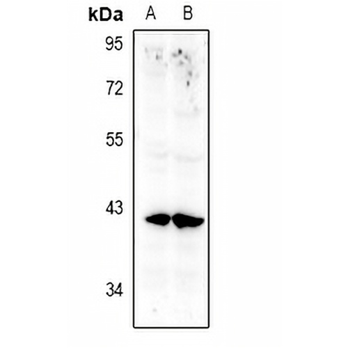 Annexin A10 Rabbit Polyclonal Antibody