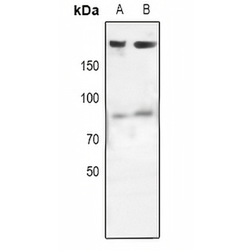EGFR Rabbit Polyclonal Antibody