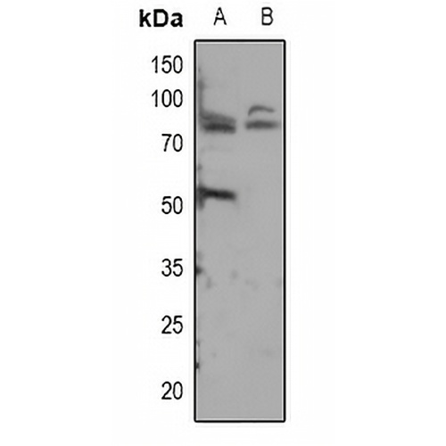 ADAM12-S Rabbit Polyclonal Antibody