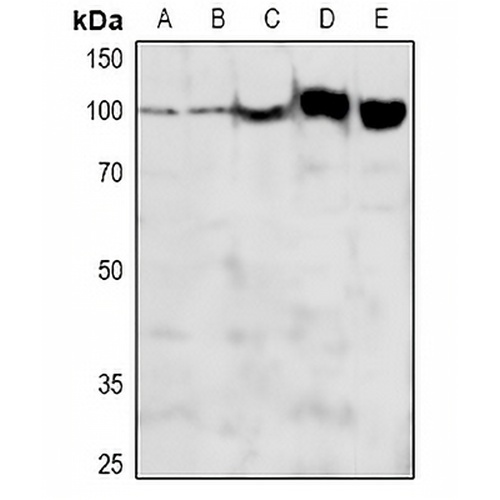 ADAM12-L Rabbit Polyclonal Antibody