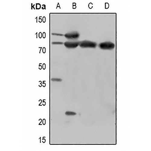 Beta-catenin (Phospho-Y670) Rabbit Polyclonal Antibody