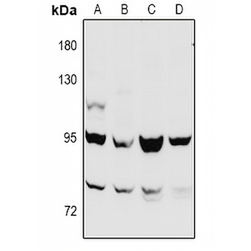 Beta-catenin Rabbit Polyclonal Antibody