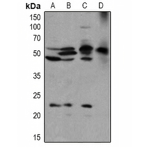 BLK (Phospho-Y389) Rabbit Polyclonal Antibody