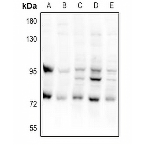 CEP95 Rabbit Polyclonal Antibody