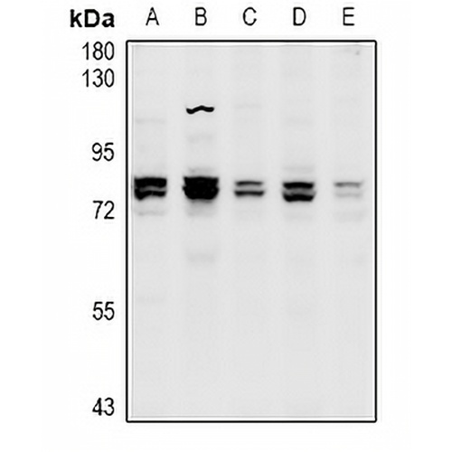 CNGA1 Rabbit Polyclonal Antibody