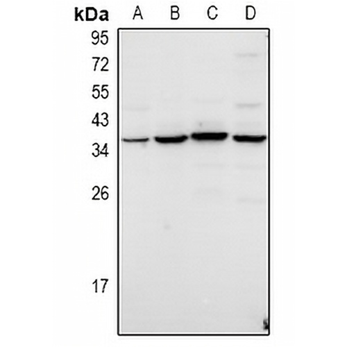 TWIK3 Rabbit Polyclonal Antibody