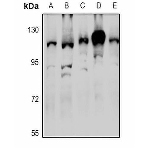 RNF111 Rabbit Polyclonal Antibody