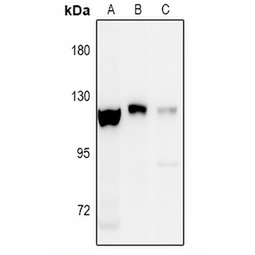 EPHA8 (Phospho-Y838) Rabbit Polyclonal Antibody