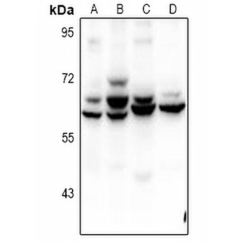 ZNF498 Rabbit Polyclonal Antibody