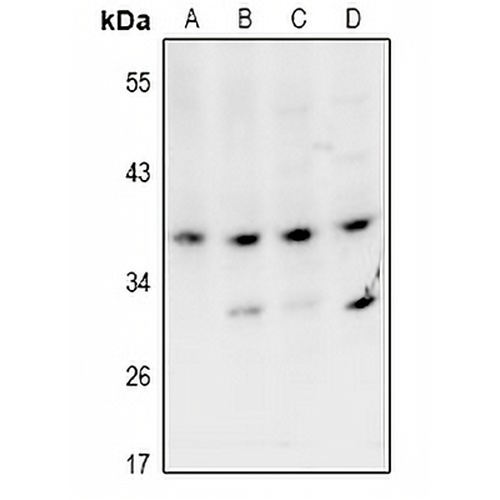 VPS26B Rabbit Polyclonal Antibody