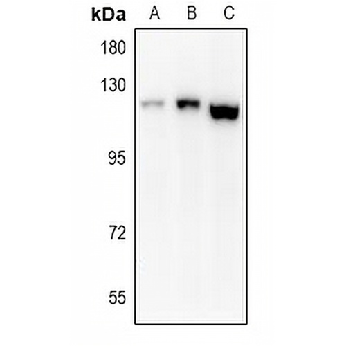 EPHA8 Rabbit Polyclonal Antibody