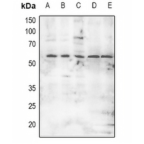 MNK2 (Phospho-T249) Rabbit Polyclonal Antibody