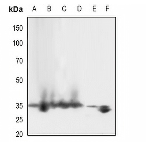 LAT (Phospho-Y161) Rabbit Polyclonal Antibody