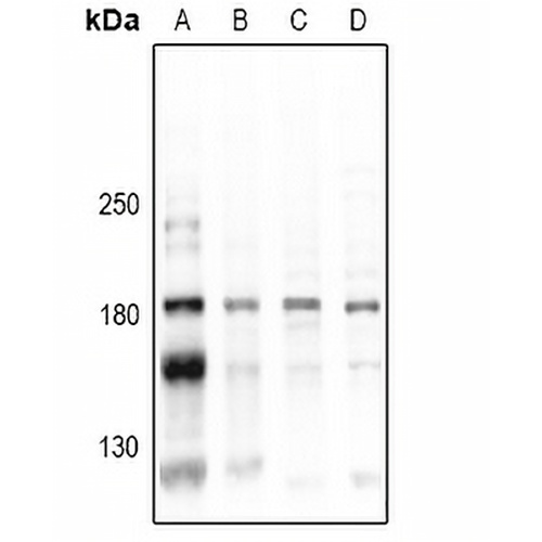 CD45 (Phospho-Y1216) Rabbit Polyclonal Antibody
