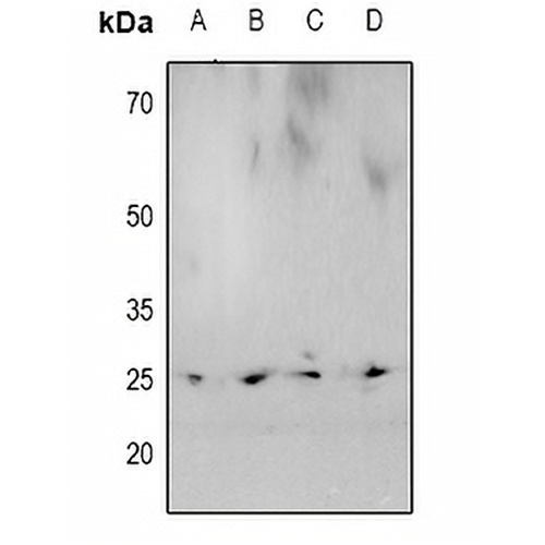 HP1 alpha (Phospho-S92) Rabbit Polyclonal Antibody