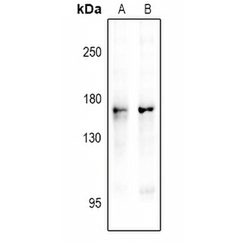 nNOS (Phospho-S1417) Rabbit Polyclonal Antibody