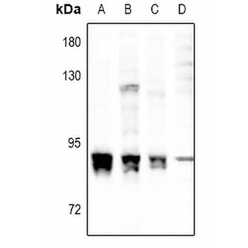 PKC alpha (Phospho-S657) Rabbit Polyclonal Antibody