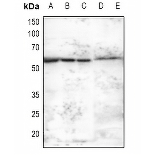 MNK2 Rabbit Polyclonal Antibody