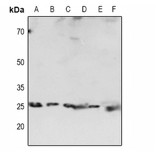 HP1 alpha Rabbit Polyclonal Antibody