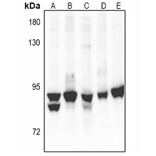 PKC alpha Rabbit Polyclonal Antibody