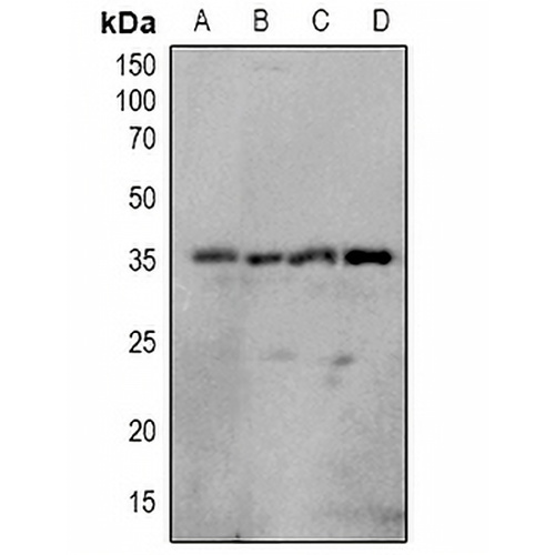 OTUB1 (Phospho-S187) Rabbit Polyclonal Antibody
