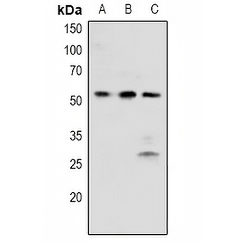BRK (Phospho-Y342) Rabbit Polyclonal Antibody