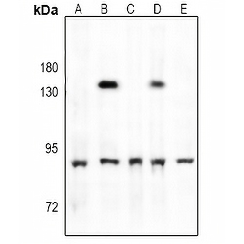 TBK1 (Phospho-S172) Rabbit Polyclonal Antibody