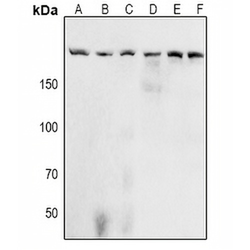 Acinus (Phospho-S1180) Rabbit Polyclonal Antibody