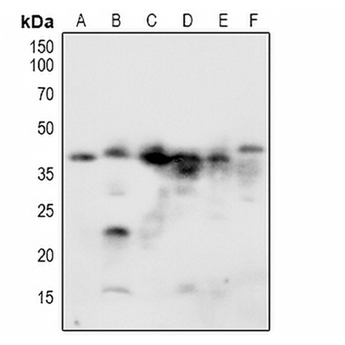 NACA1 (Phospho-S43) Rabbit Polyclonal Antibody