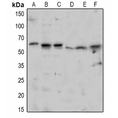 TAB1 (Phospho-S438) Rabbit Polyclonal Antibody