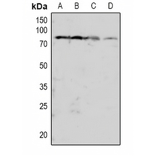 PKC beta (Phospho-T641) Rabbit Polyclonal Antibody