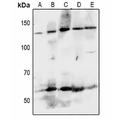 EPHA8 Rabbit Polyclonal Antibody