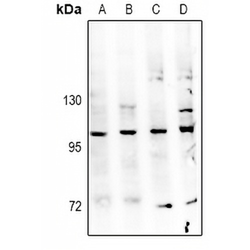 TBK1 Rabbit Polyclonal Antibody