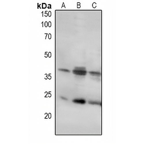 LAT Rabbit Polyclonal Antibody