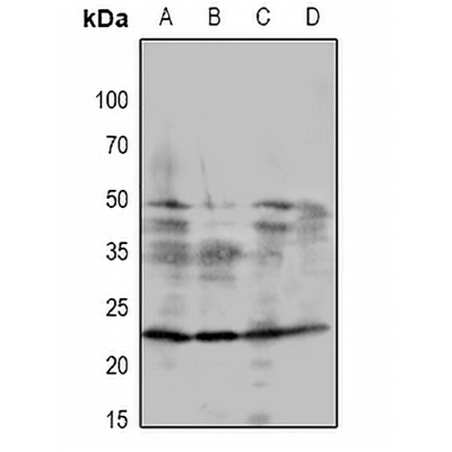 DSCR1 Rabbit Polyclonal Antibody