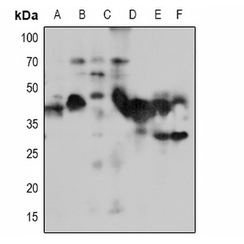 NACA1 Rabbit Polyclonal Antibody