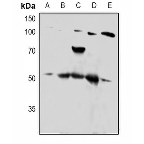 PTP1B Rabbit Polyclonal Antibody