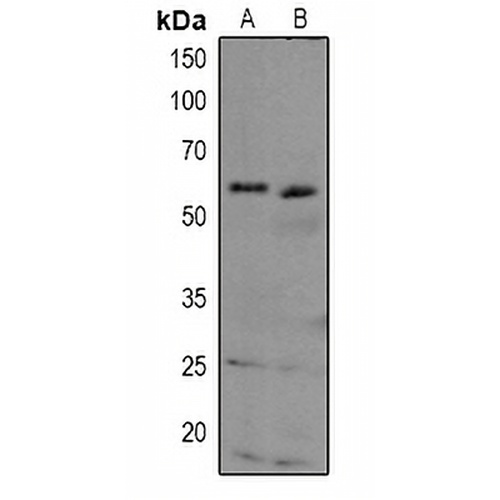 TAB1 Rabbit Polyclonal Antibody