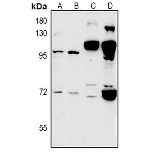 CLIC6 Rabbit Polyclonal Antibody