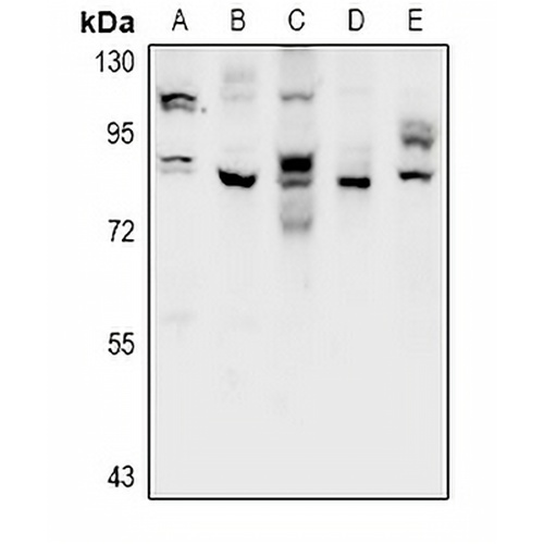 CSGLCAT Rabbit Polyclonal Antibody