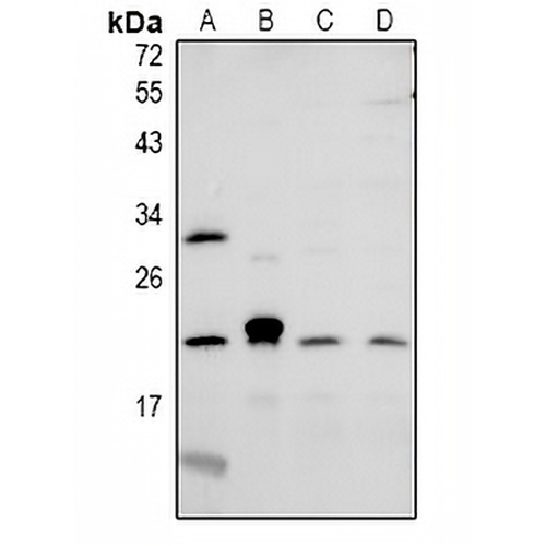 CMTM6 Rabbit Polyclonal Antibody